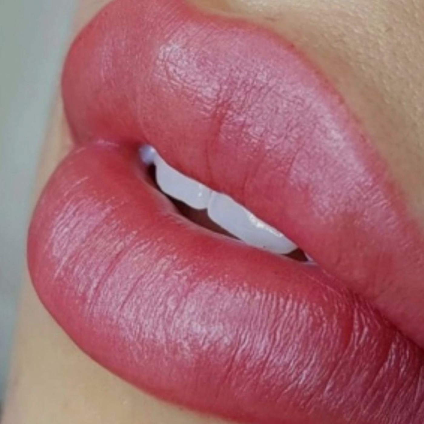 Smile Perfecto – Eindruck 3